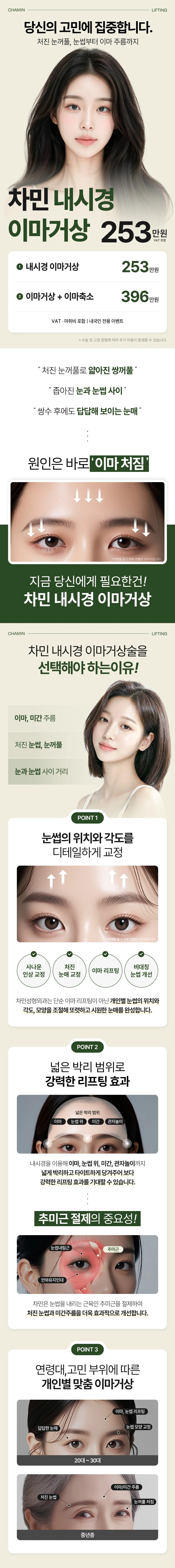 차민성형외과 차민 내시경 이마거상술 이벤트, 시술 상세 이미지