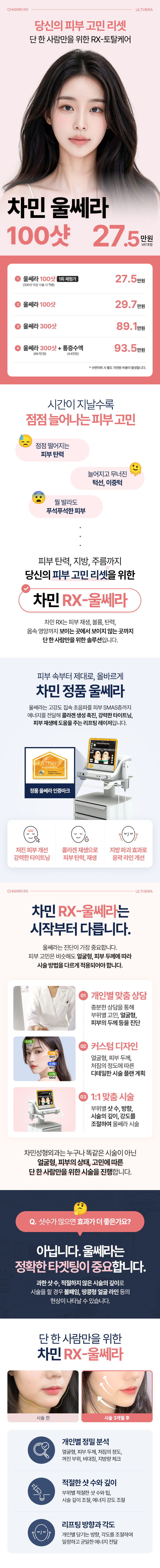 차민성형외과 차민 RX-울쎄라 이벤트, 시술 상세 이미지