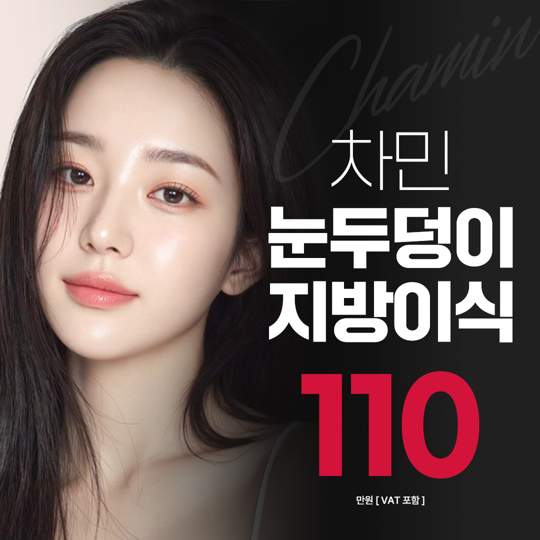 차민 눈두덩이 지방이식 이벤트 썸네일 이미지