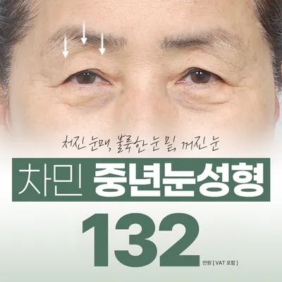 차민 중년눈성형 이벤트 썸네일 이미지