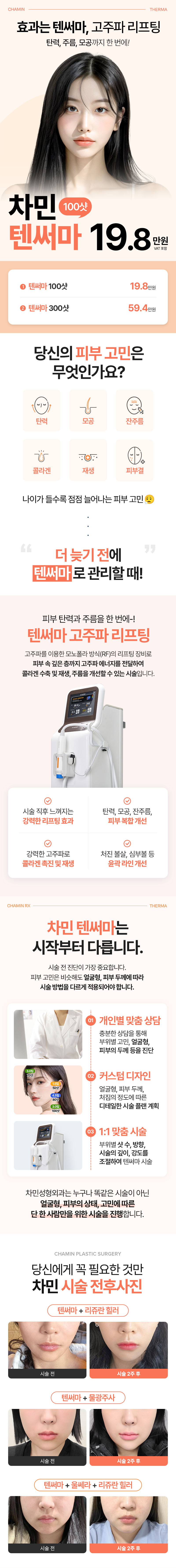 차민성형외과 차민 텐써마리프팅 이벤트, 시술 상세 이미지