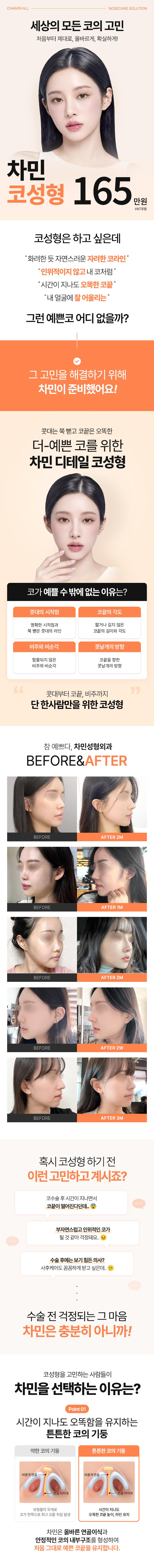 차민성형외과 차민 코성형 이벤트, 시술 상세 이미지