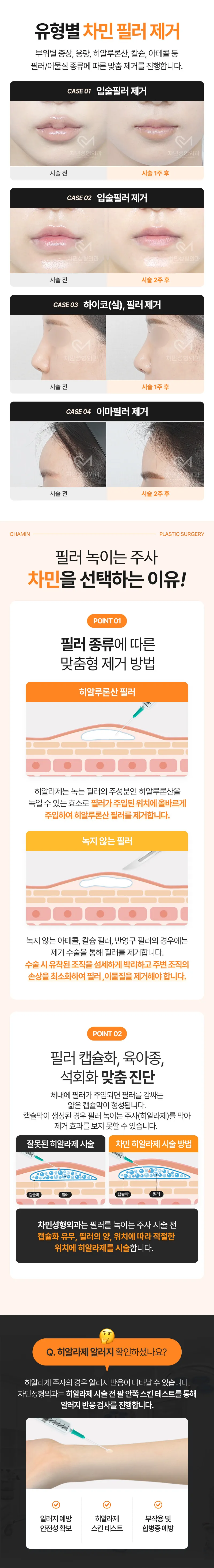 차민성형외과 차민 필러녹이는주사 이벤트, 시술 상세 이미지