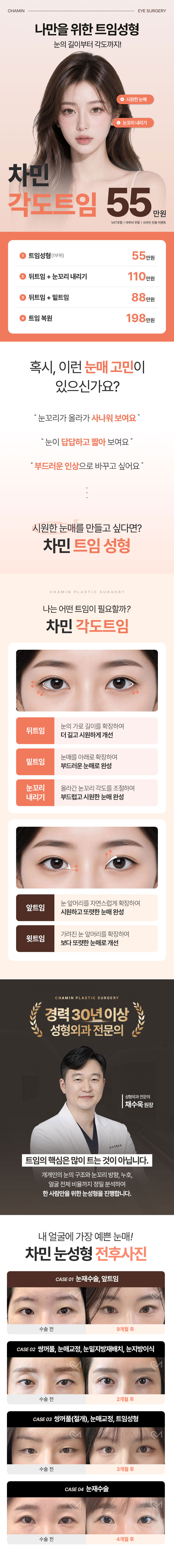 차민 각도트임