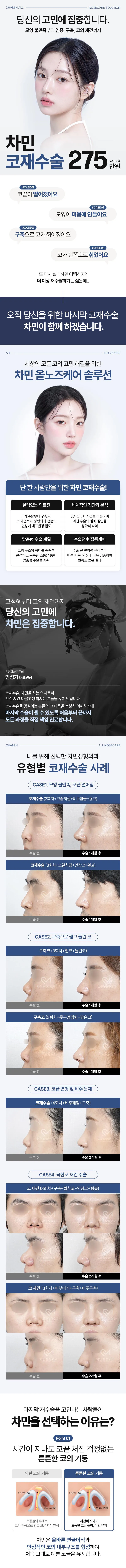 차민성형외과 차민 코재수술 275 이벤트, 시술 상세 이미지