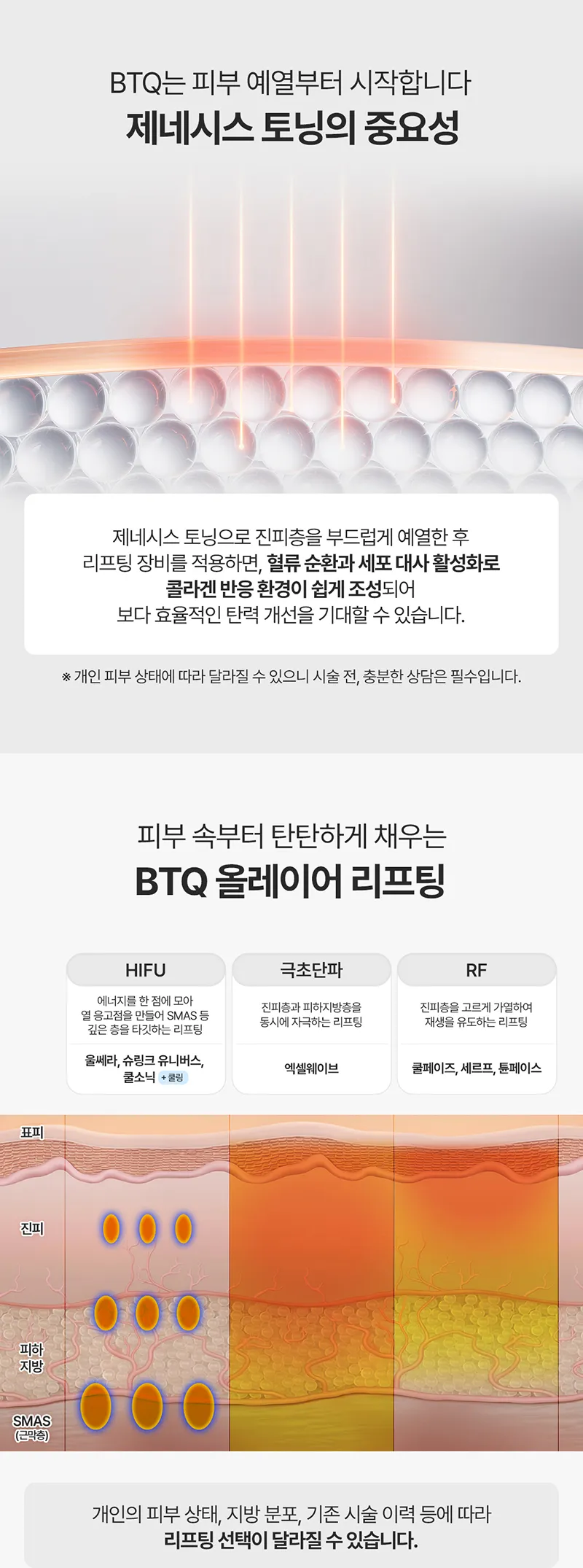 비티큐의원 BTQ 원데이 올레이어 리프팅 이벤트, 시술 상세 이미지