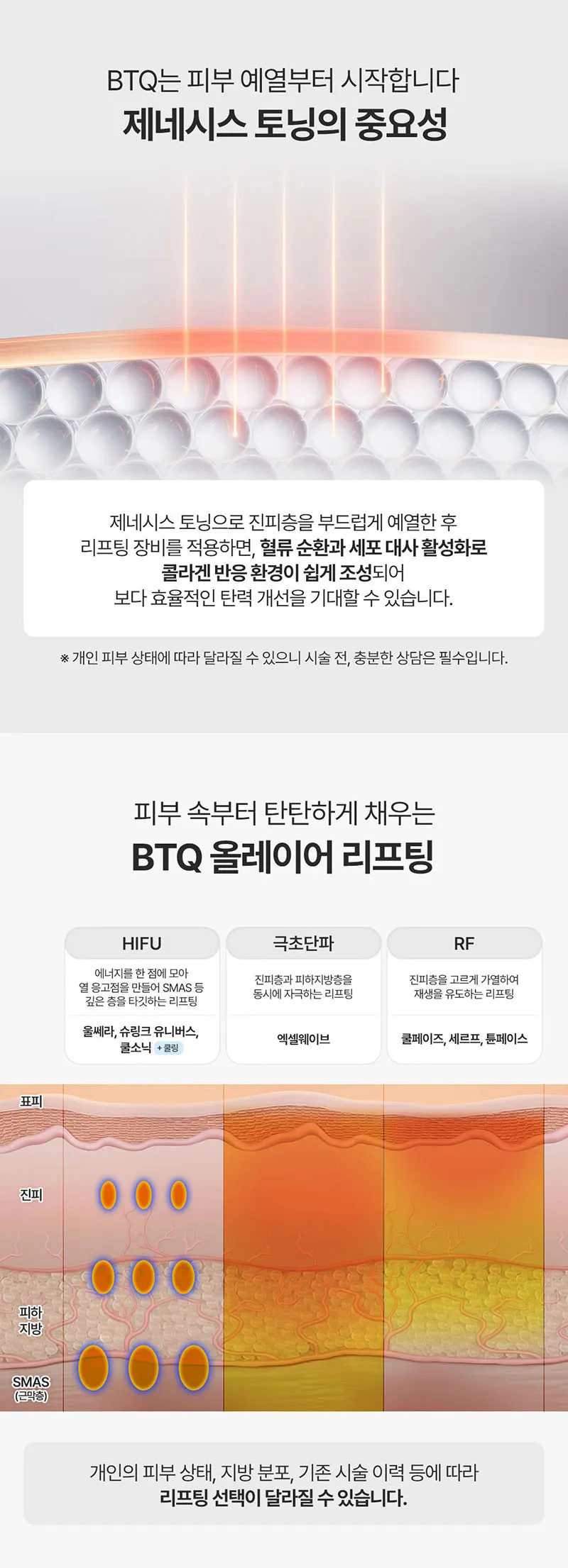 비티큐의원 BTQ 원데이 올레이어 리프팅 이벤트, 시술 상세 이미지