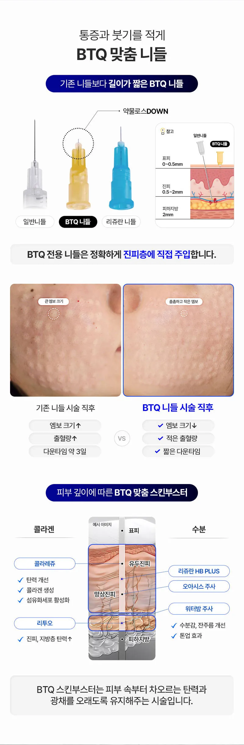 비티큐의원 BTQ 커스터마이징 스킨부스터 이벤트, 시술 상세 이미지
