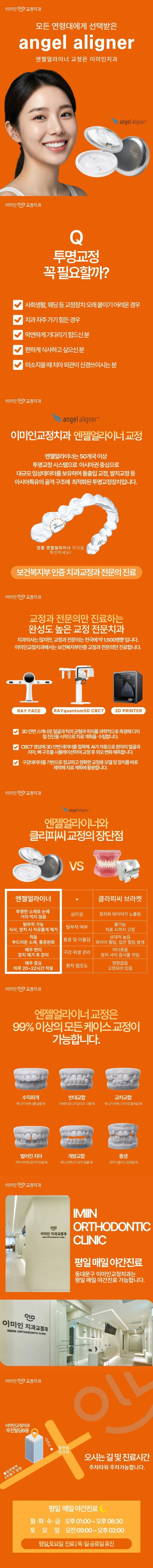 이미인치과교정과의원 동대문 나에게 맞춘 퍼스널 투명교정 이벤트, 시술 상세 이미지