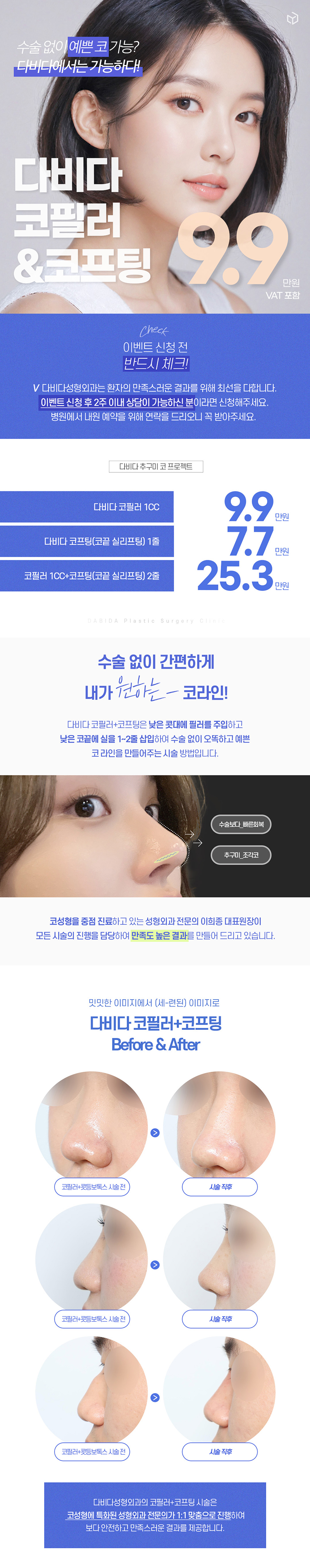 다비다성형외과의원 다비다 코필러, 코프팅 이벤트, 시술 상세 이미지