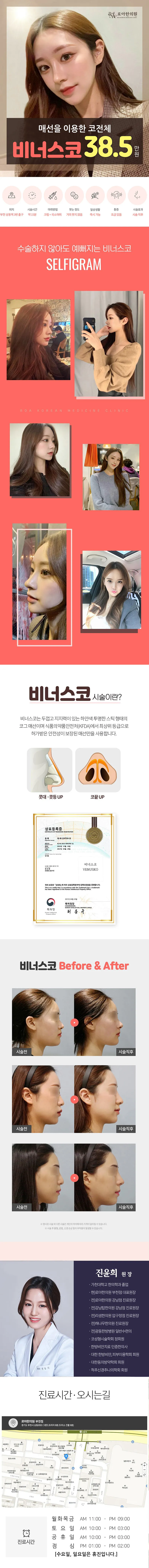 로아한의원 부천점 매선을 이용한 비너스코, 후기좋은곳 이벤트, 시술 상세 이미지