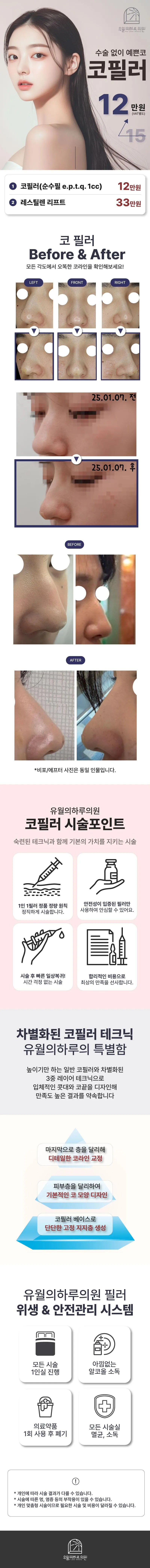 유월의하루의원 유월의하루 커스텀 코필러 이벤트, 시술 상세 이미지