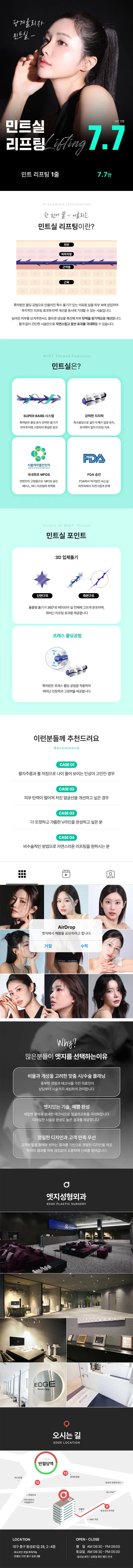 엣지성형외과 대구 엣지 맞춤 민트실리프팅 이벤트, 시술 상세 이미지