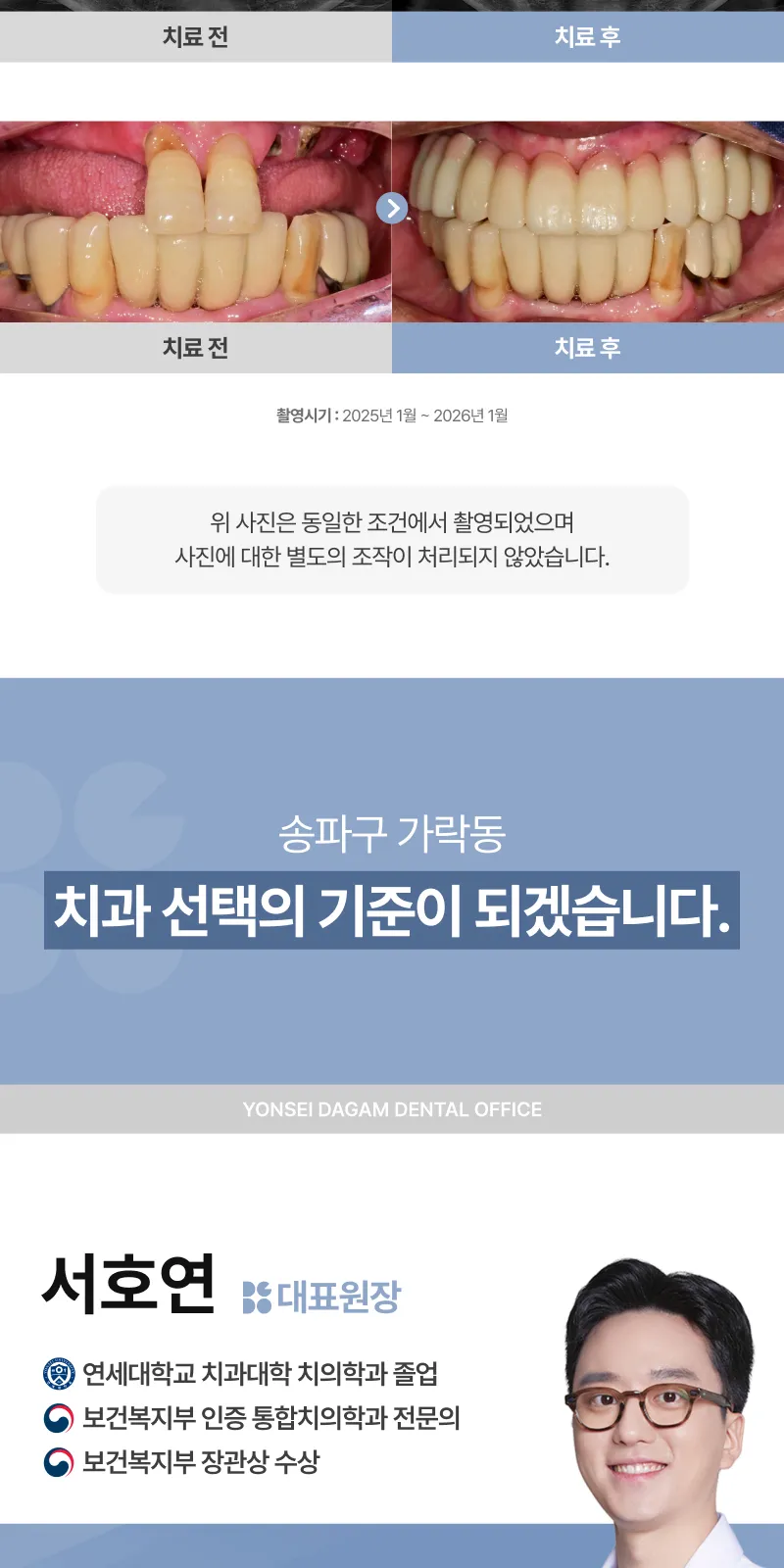 무절개 임플란트, 오스템 BA
