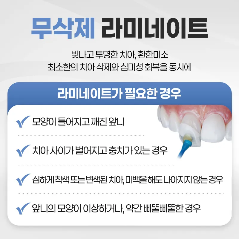 연세다감치과 치아손상 없는 무삭제 라미네이트 이벤트, 시술 상세 이미지