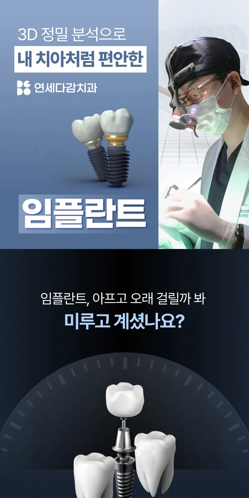 무절개 임플란트, 오스템 SOI