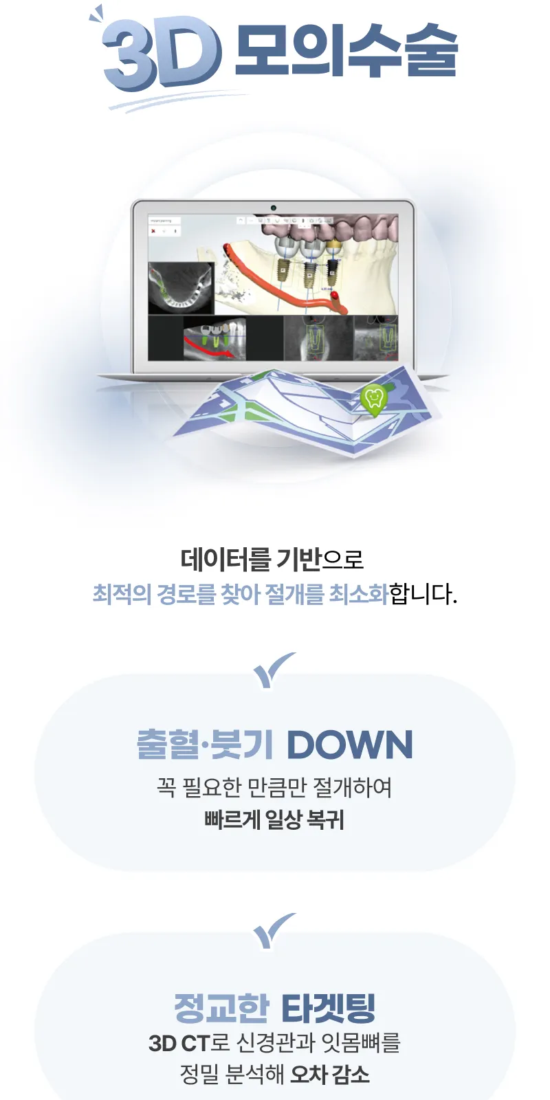 무절개 임플란트, 오스템 SOI