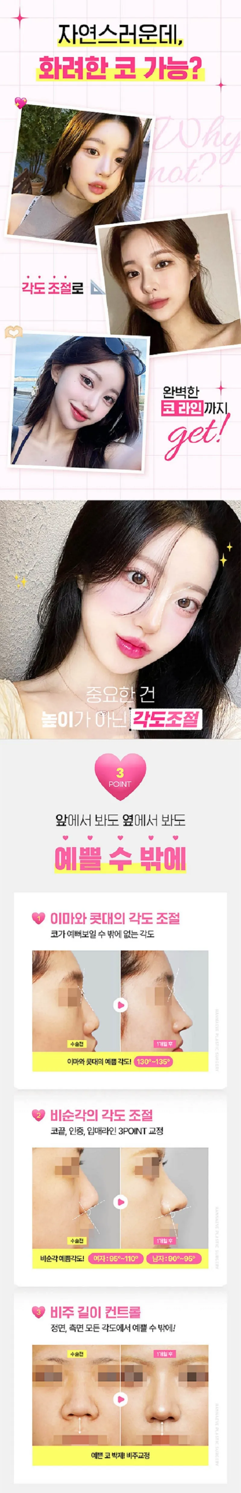 한나이브성형외과의원 자려한 콧대코끝 커스텀성형 이벤트, 시술 상세 이미지