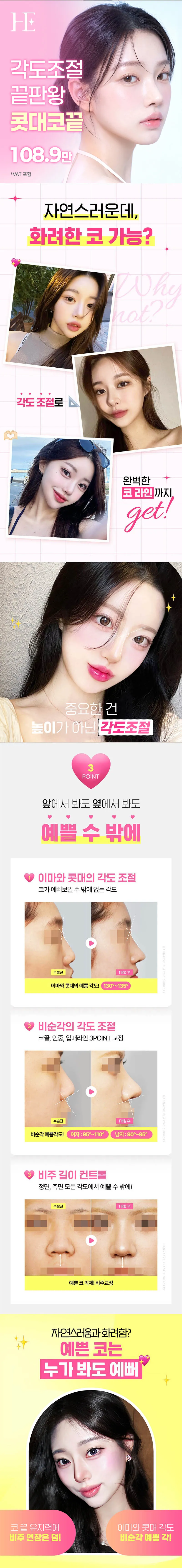 자려한 콧대코끝 커스텀성형