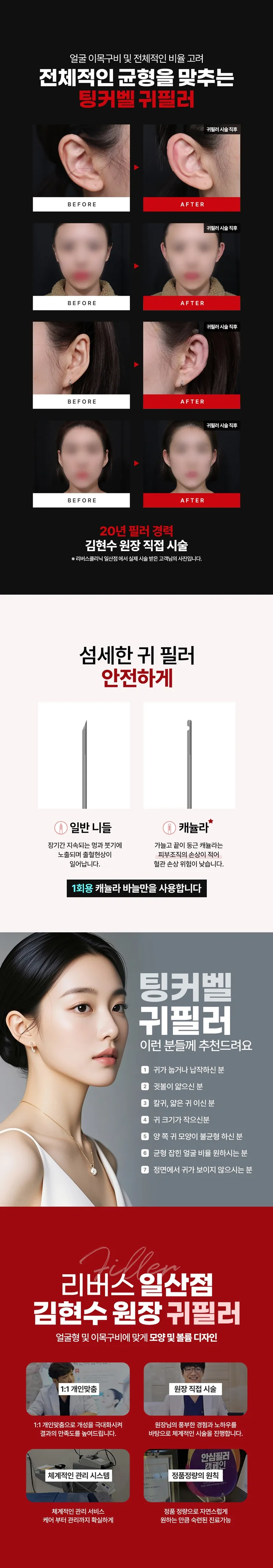 리버스클리닉 일산 일산 - 귀필러 대표원장 단독 시술 이벤트, 시술 상세 이미지