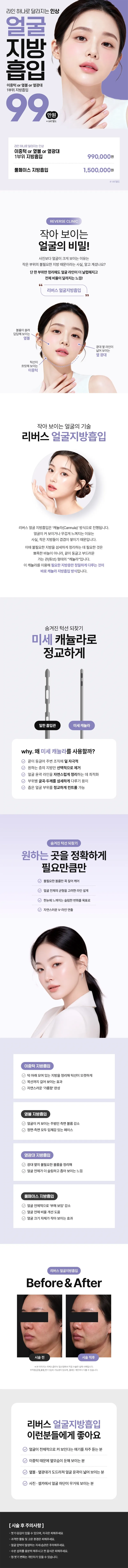 리버스클리닉 일산 일산 얼굴지방흡입 EVENT 이벤트, 시술 상세 이미지
