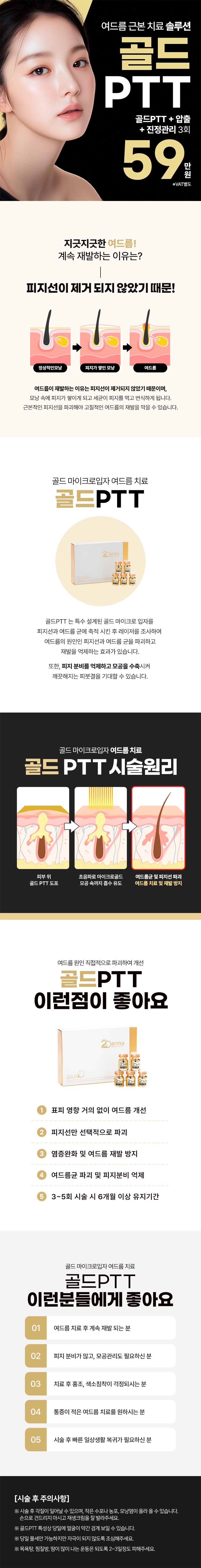 리버스클리닉 일산 일산 골드PTT 여드름 근본치료솔루션 이벤트, 시술 상세 이미지