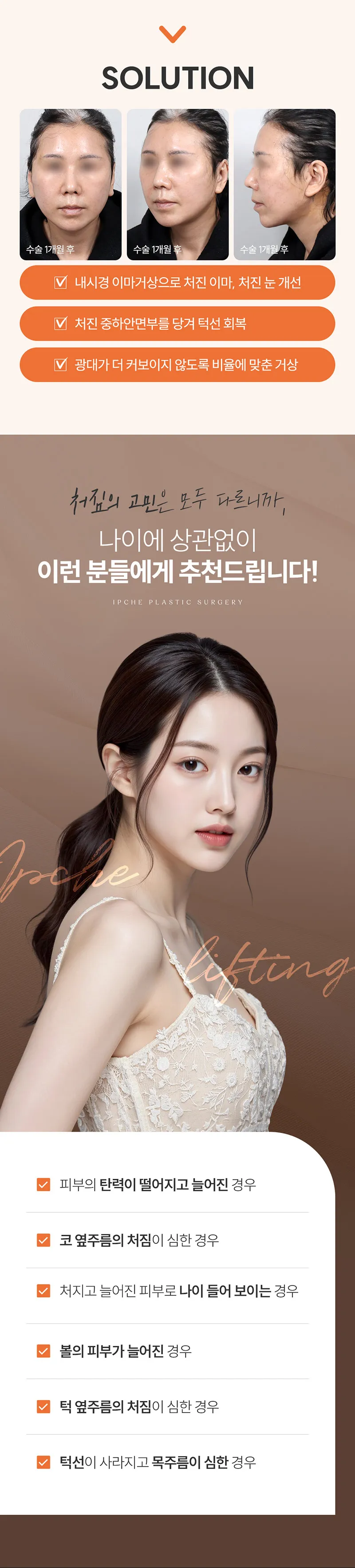 입체성형외과의원 입체 SMAS 안면거상 이벤트, 시술 상세 이미지