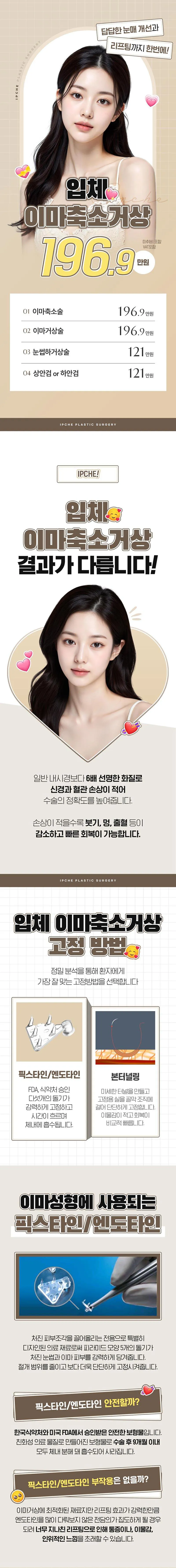 입체성형외과의원 입체 이마축소거상 이벤트, 시술 상세 이미지