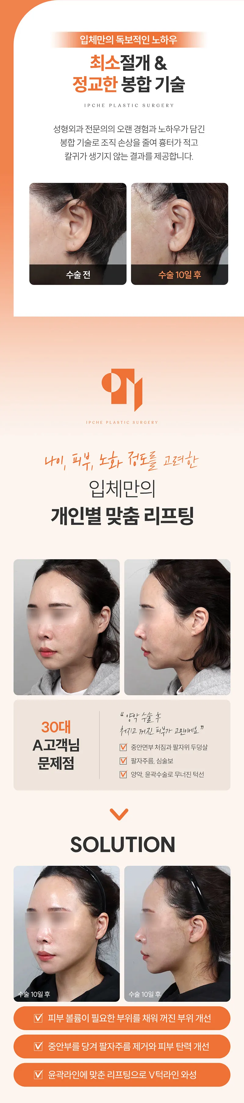 입체성형외과의원 입체 SMAS 안면거상 이벤트, 시술 상세 이미지