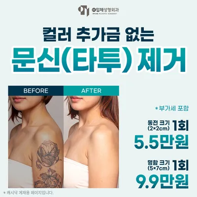 추가금 없는 문신(타투)제거 이벤트 썸네일 이미지