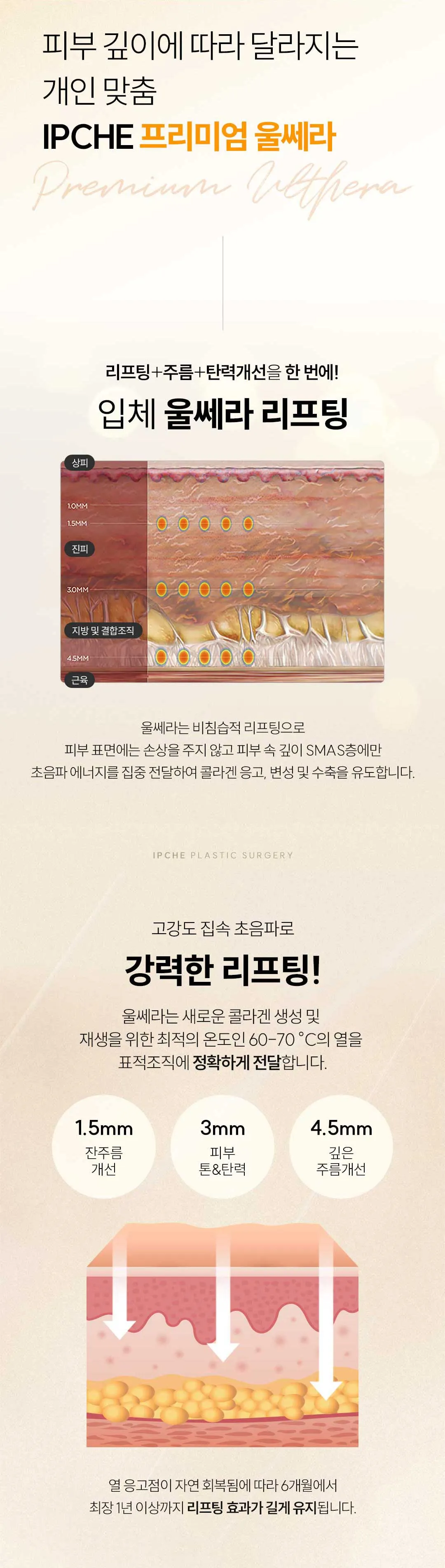 입체성형외과의원 [1인 원장] 정품정샷 울쎄라 리프팅 이벤트, 시술 상세 이미지