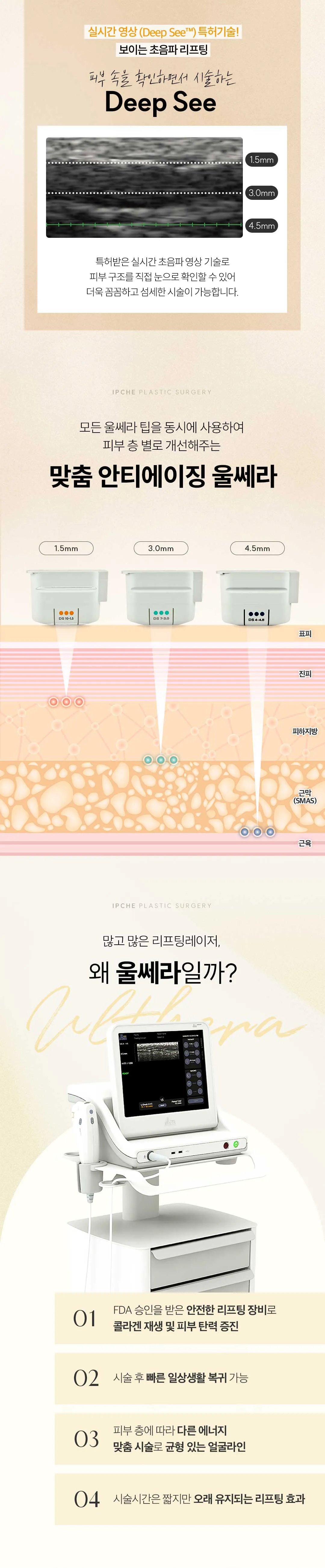 입체성형외과의원 [1인 원장] 정품정샷 울쎄라 리프팅 이벤트, 시술 상세 이미지