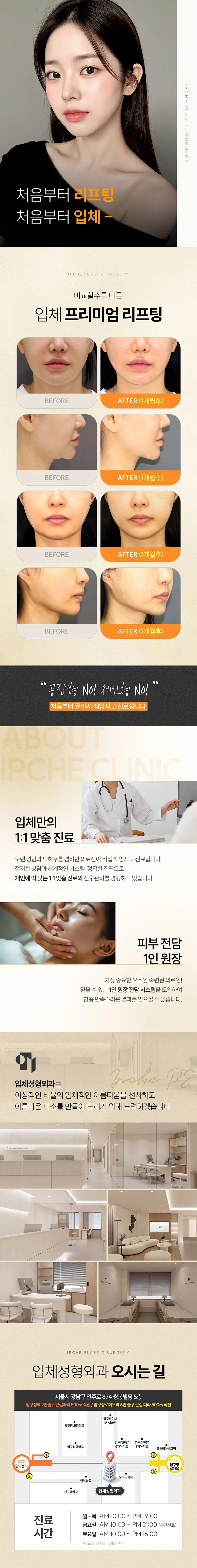 입체성형외과의원 [1인 원장] 텐써마 리프팅 300샷 이벤트, 시술 상세 이미지