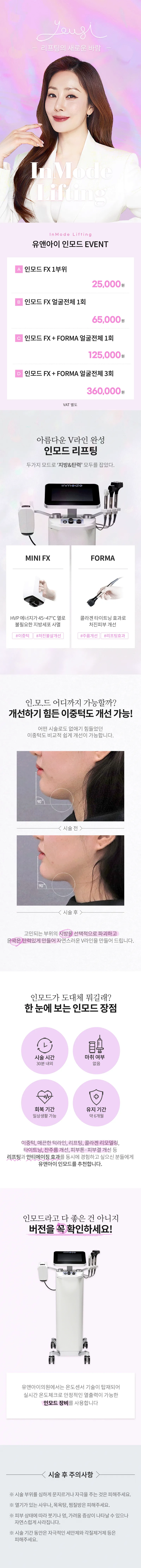 유앤아이의원 창동점 창동) V라인 만드는 인모드 리프팅 이벤트, 시술 상세 이미지