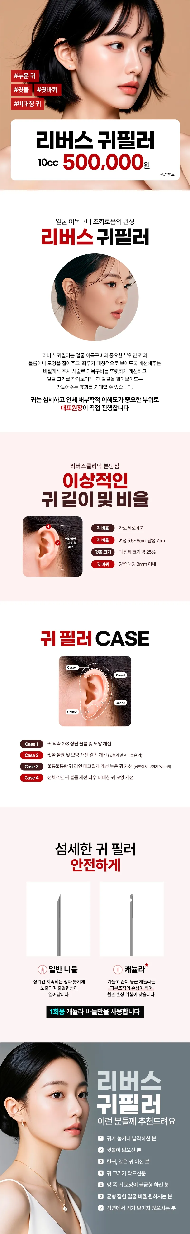 리버스의원(분당점) 분당 귀필러 누운귀 귓바퀴 비대칭귀 이벤트, 시술 상세 이미지