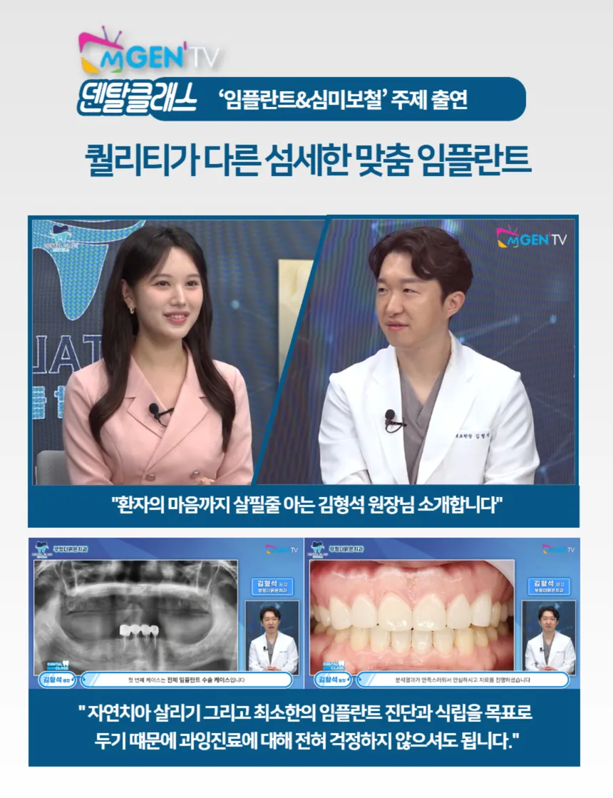 [원내 기공소 보유] 무삭제 케이 라미네이트💙