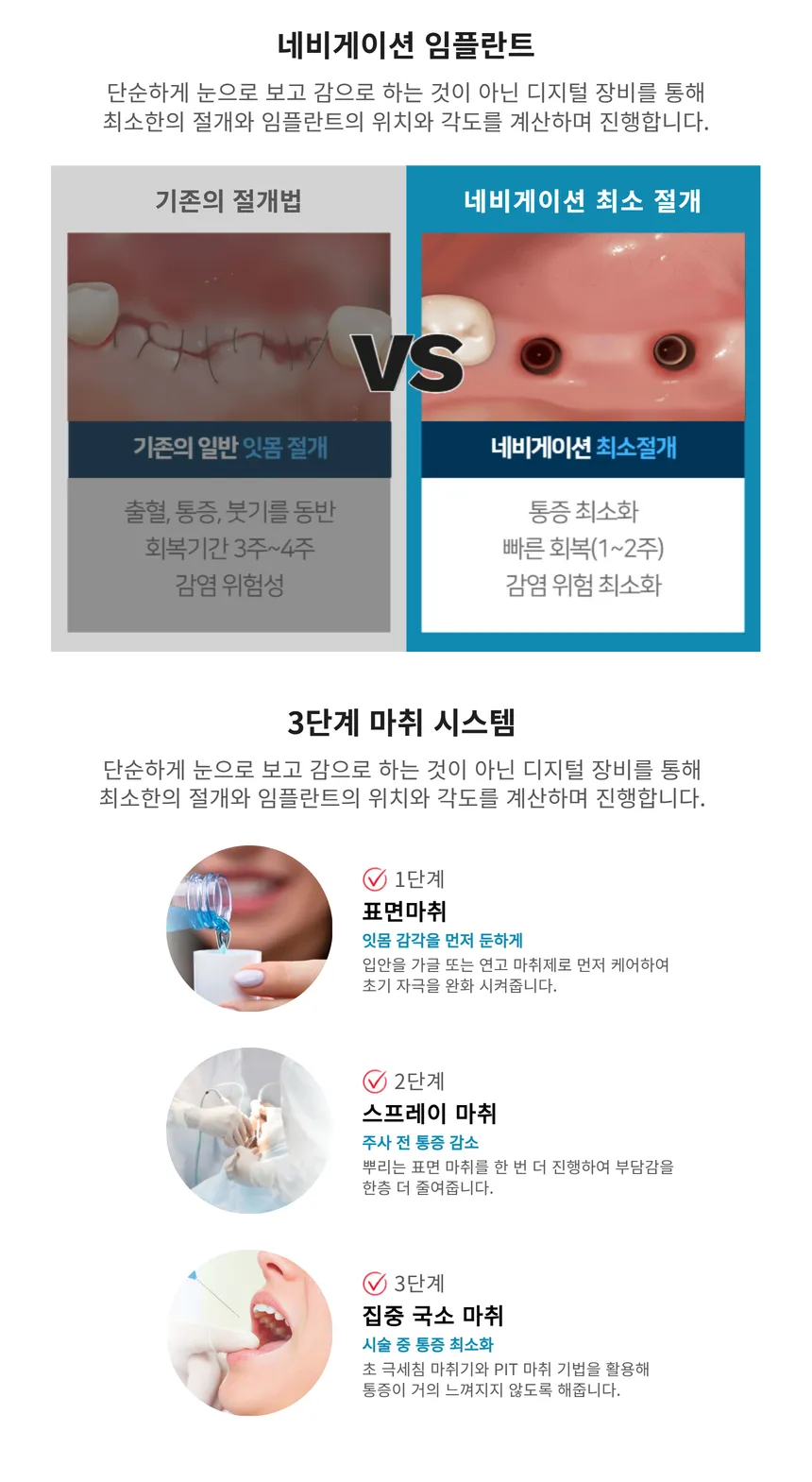 국산 정품 오스템 임플란트 39만원💙