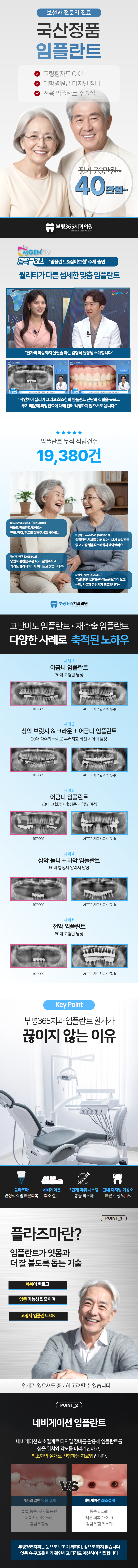 부평365치과의원 국산정품 임플란트 40만원💛 이벤트, 시술 상세 이미지
