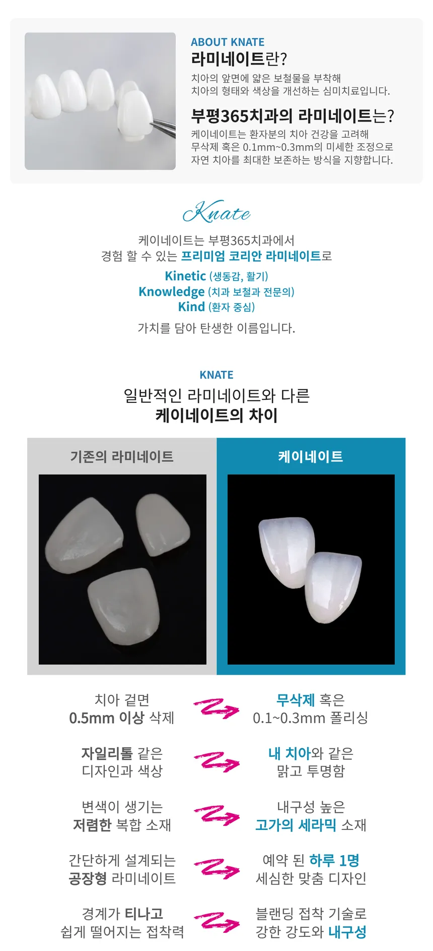 [원내 기공소 보유] 무삭제 케이 라미네이트💙