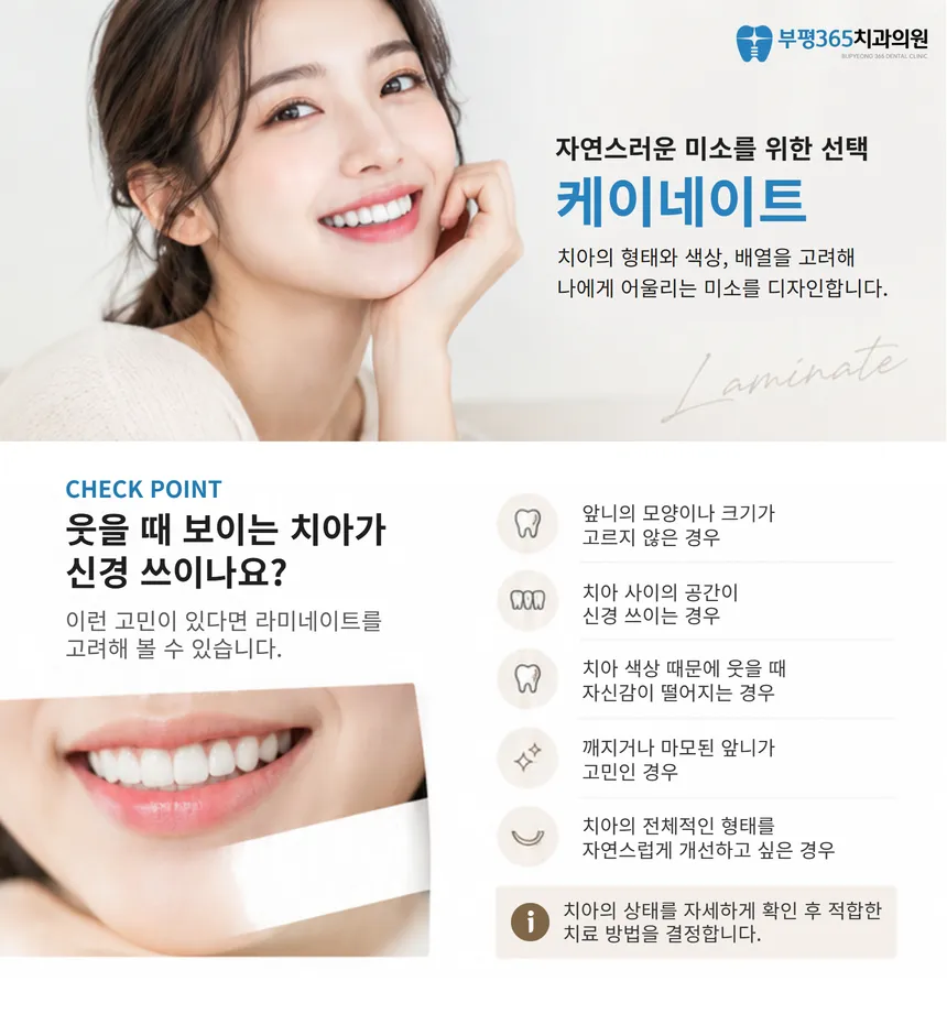 [원내 기공소 보유] 무삭제 케이 라미네이트💙