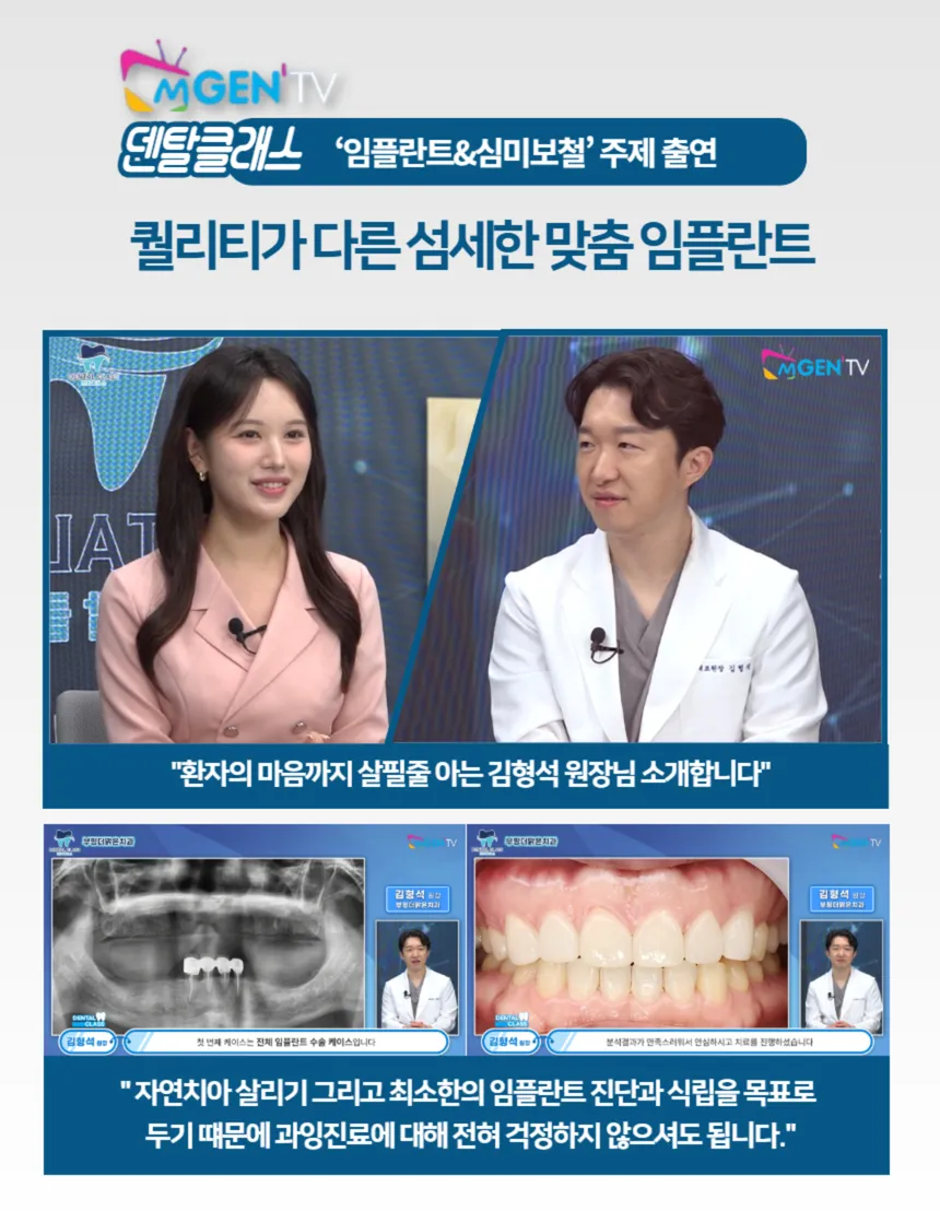 국산 정품 오스템 임플란트 39만원💙