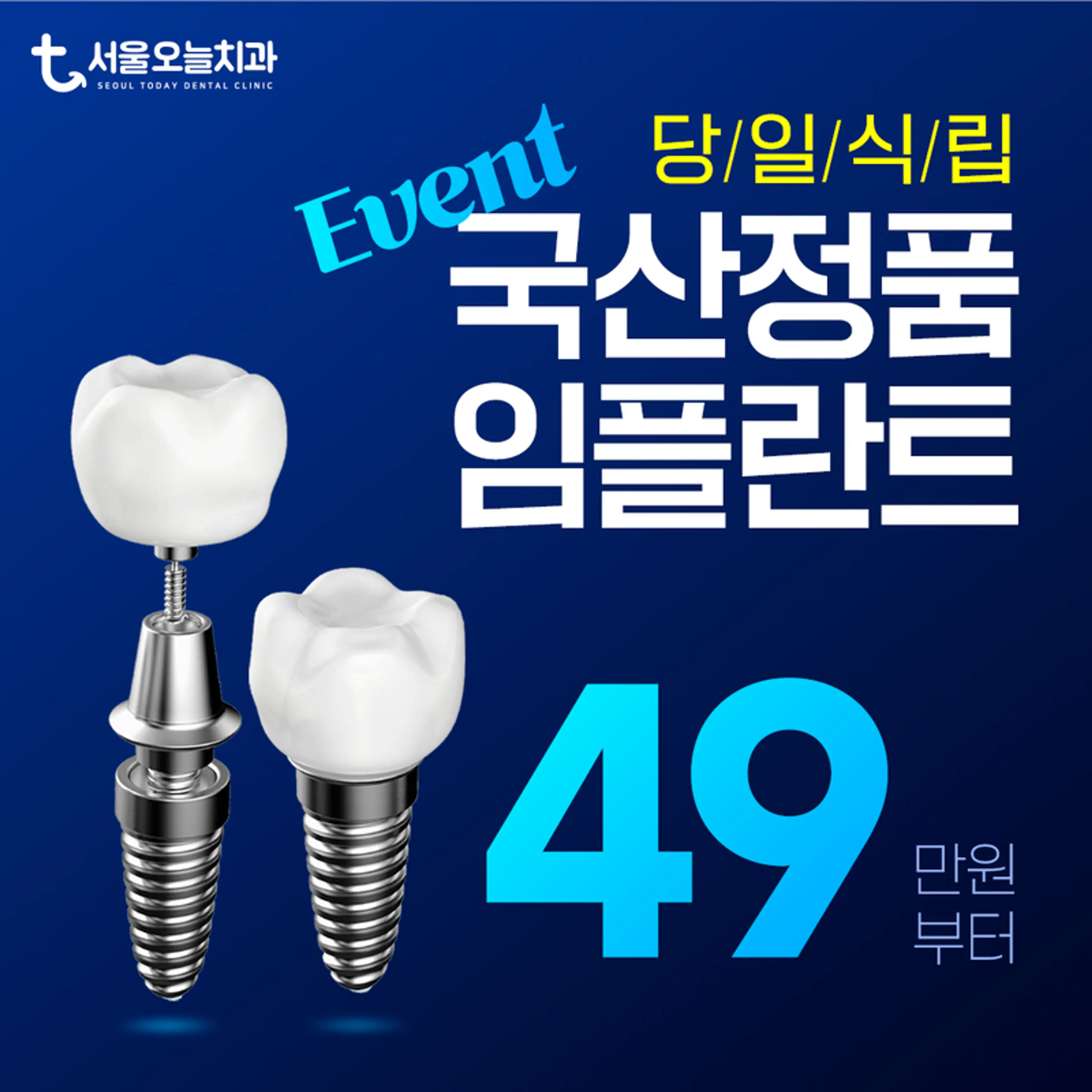 디지털 당일 임플란트