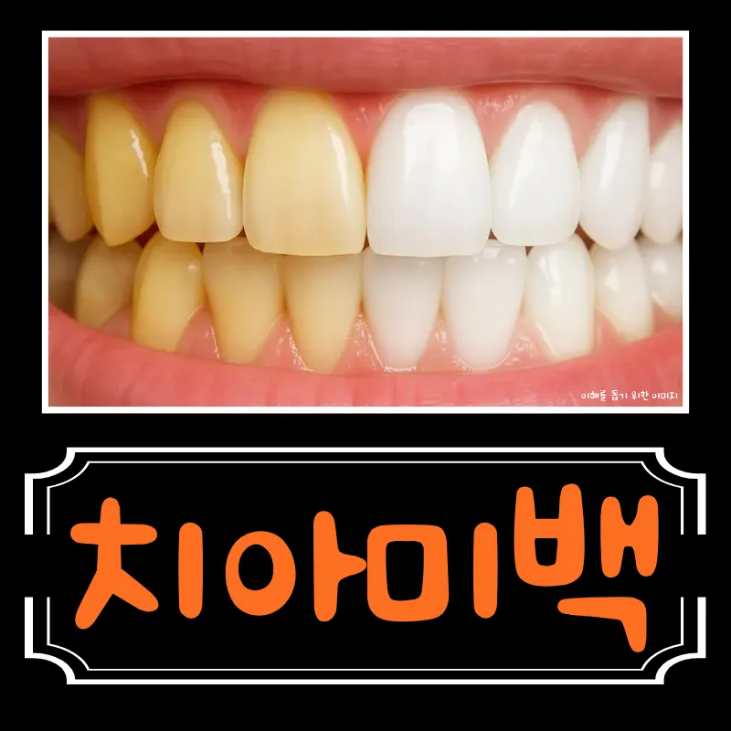 원데이 치아미백 (1일 3회) 이벤트 썸네일 이미지