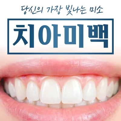 원데이 치아미백 (1일 3회) 이벤트 썸네일 이미지