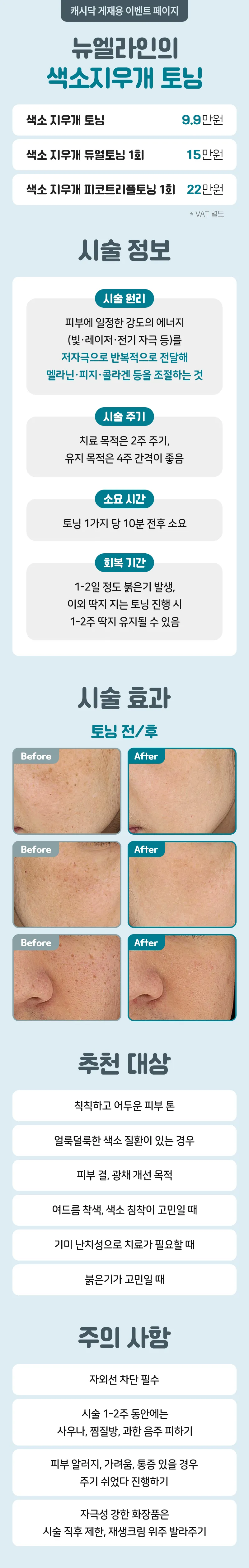 뉴엘라인의원 뉴엘라인의 색소지우개 토닝 이벤트, 시술 상세 이미지