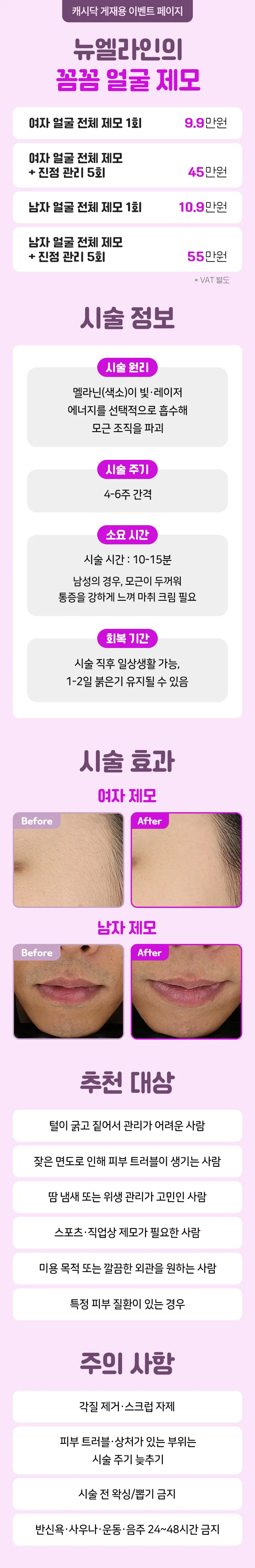 뉴엘라인의원 뉴엘라인의 꼼꼼 얼굴 제모 이벤트, 시술 상세 이미지