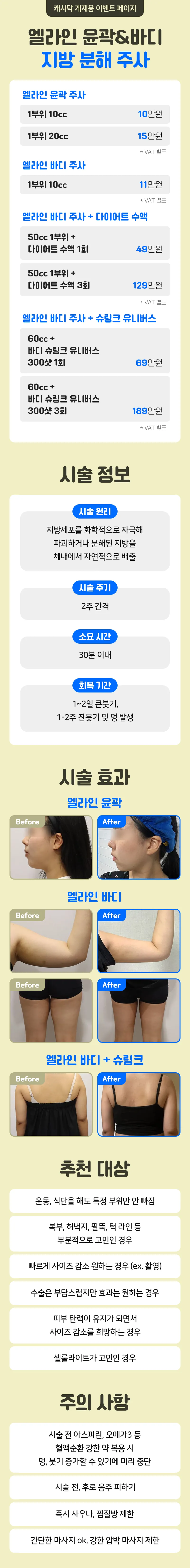 뉴엘라인의원 엘라인 윤곽&바디 지방 분해 주사 이벤트, 시술 상세 이미지