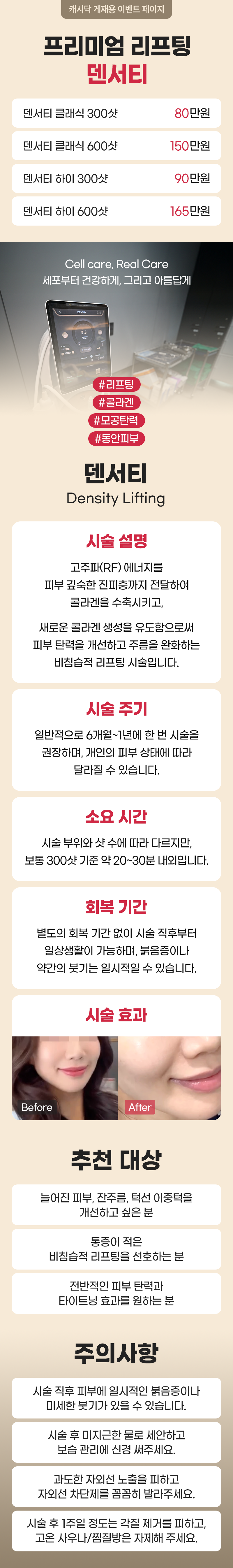 서래셀의원 [정품인증] 프리미엄 리프팅 덴서티  이벤트, 시술 상세 이미지