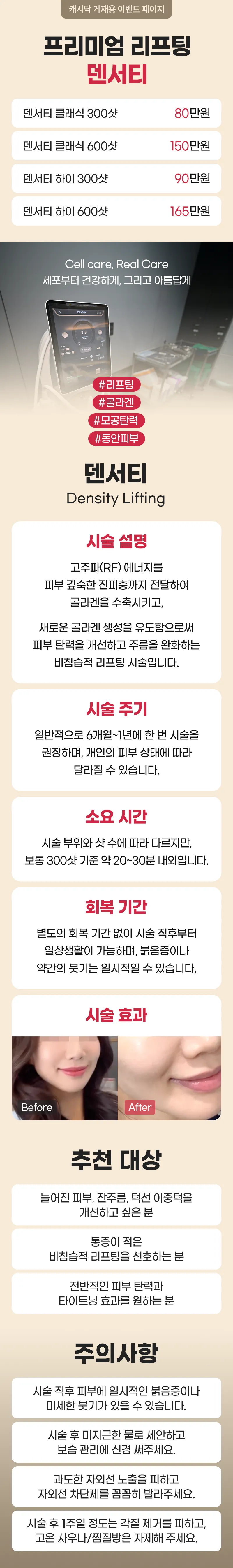 서래셀의원 [정품인증] 프리미엄 리프팅 덴서티  이벤트, 시술 상세 이미지