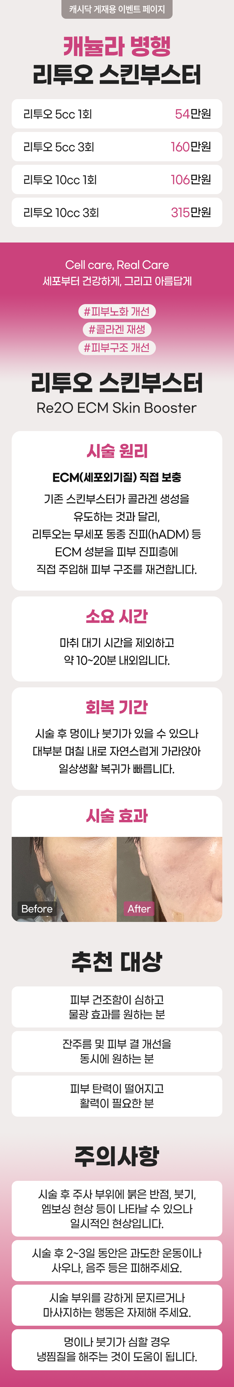 서래셀의원 [캐뉼라 병행] 리투오 스킨부스터 이벤트, 시술 상세 이미지